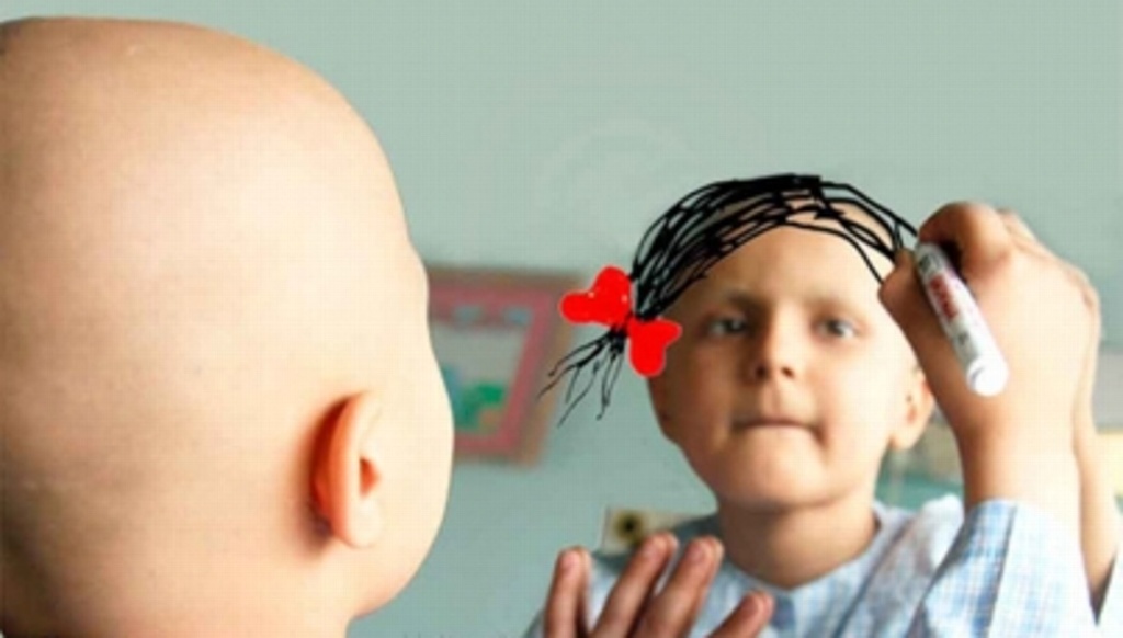 Imagen Diagnóstico temprano ayuda a salvar a niños con cáncer