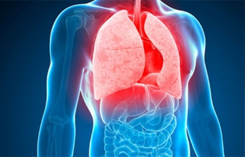 Imagen Tuberculosis, asociada con desnutrición y bajas defensas especialista