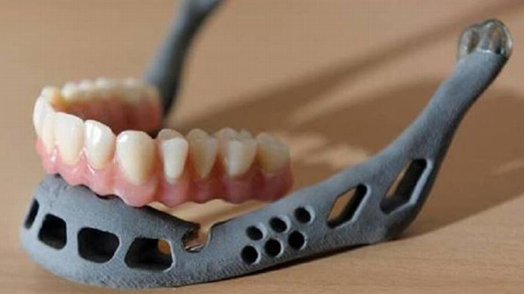 Imagen Realizan primer trasplante de mandíbula 3D