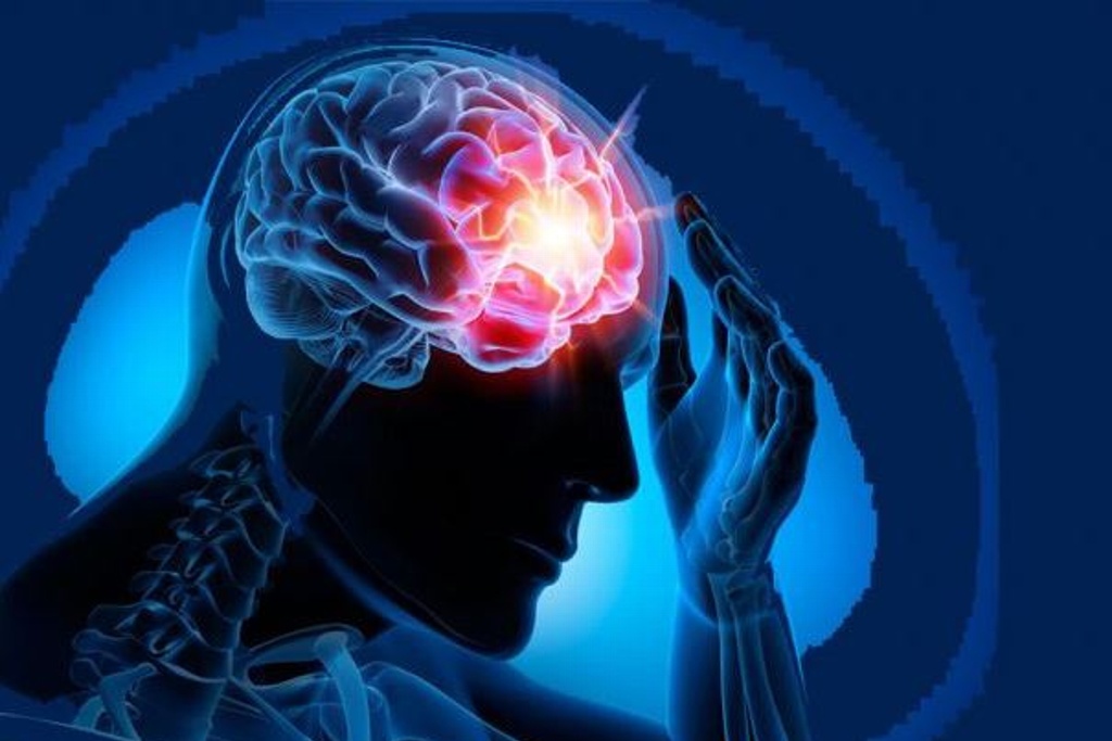Imagen Epilepsia, patología que se debe a una actividad anormal del cerebro