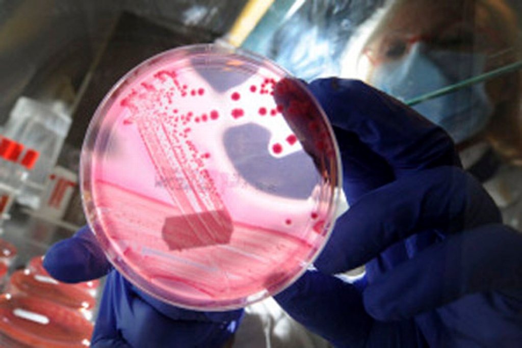 Imagen Identifican especialistas infección resistente al más potente antibiótico