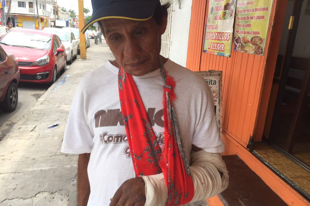 Imagen Don Federico pide apoyo para la operación de su brazo fracturado desde hace dos meses 