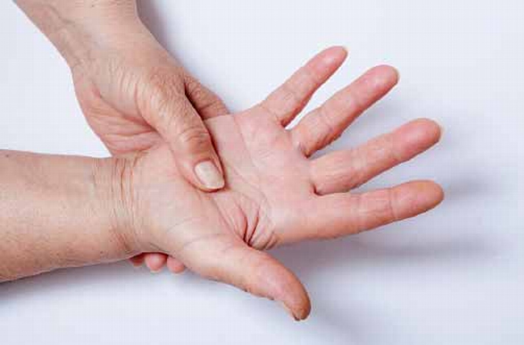 Imagen Dureza en piel y dificultad para mover manos son síntomas de esclerodermia: Especialista