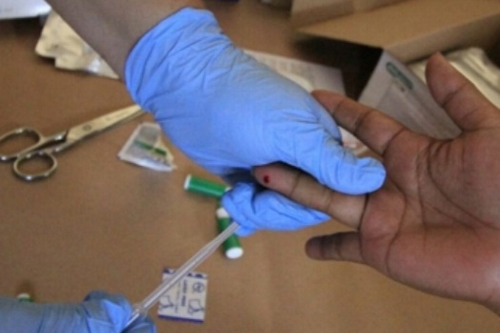 Imagen Alerta IMSS síntomas iniciales de VIH-SIDA