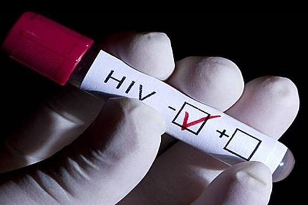 Imagen México participa en protocolo para tratamiento profiláctico de VIH