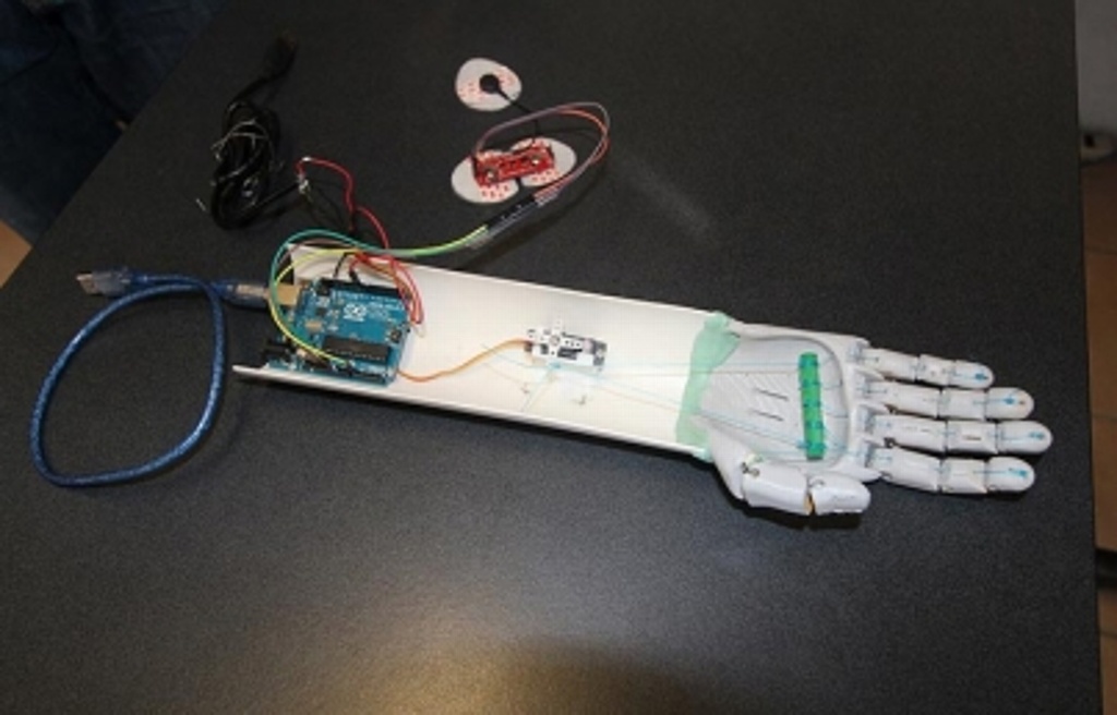 Imagen Estudiantes y egresados de la Universidad Veracruzana diseñan prototipo de mano mioeléctrica 