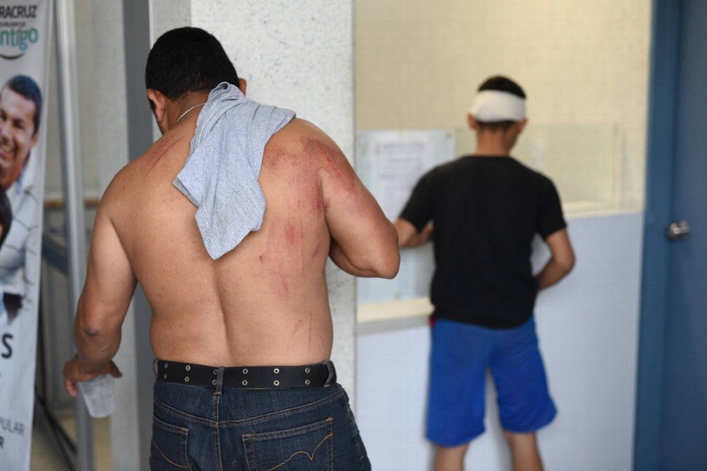 Imagen Atiende IMSS a seis migrantes lesionados por accidente carretero en Vega de Alatorre