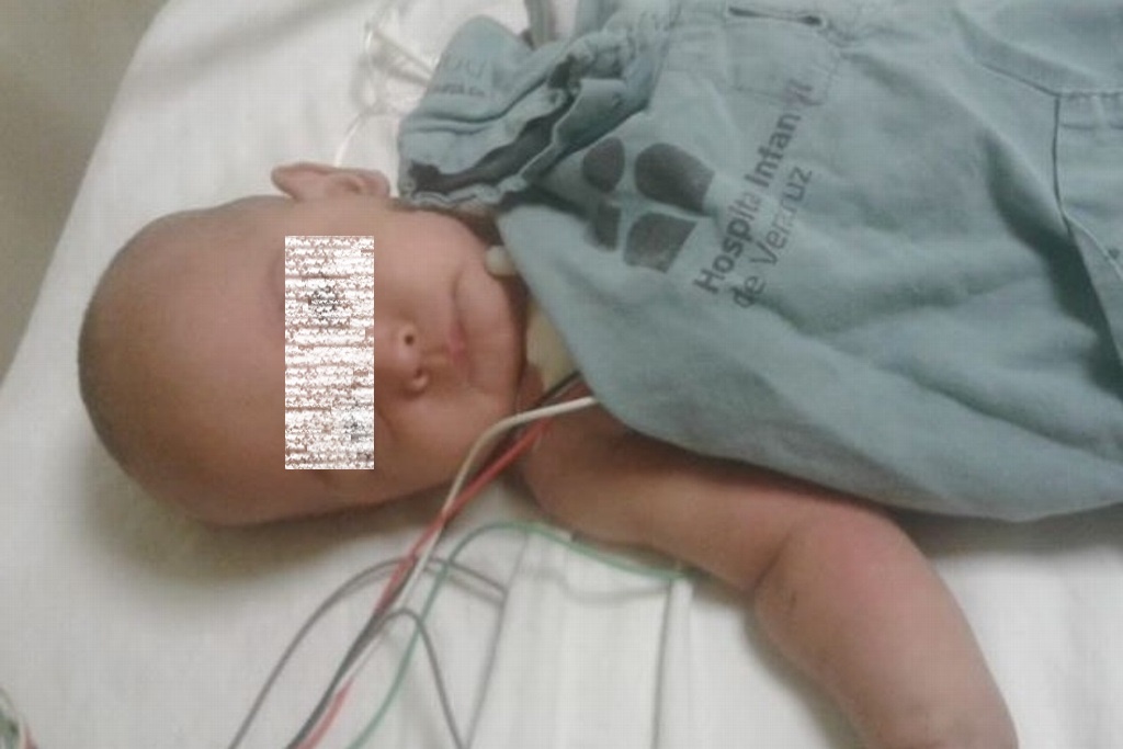 Imagen ¿Qué pasó con Diego Jhoel, el bebé de 7 meses con un tumor cancerígeno?