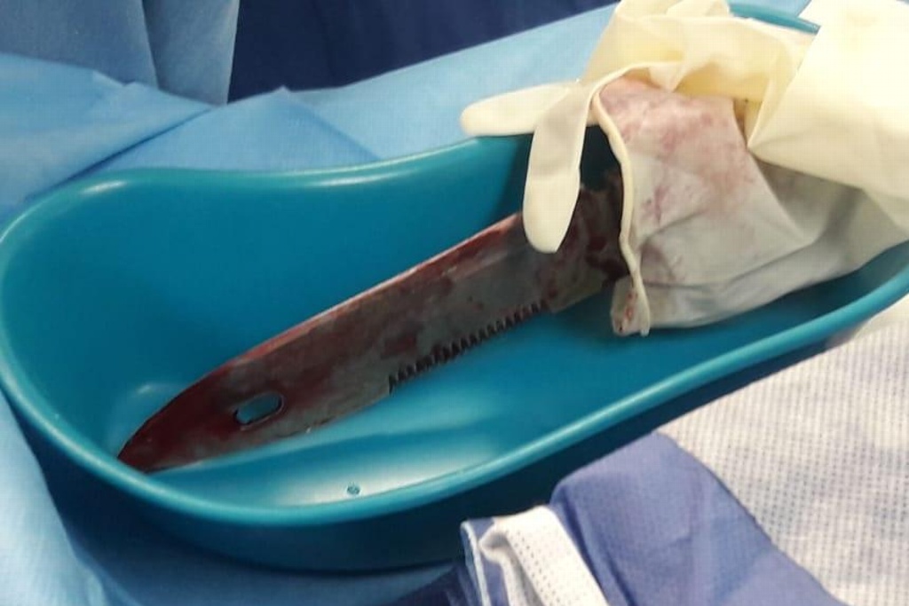 Imagen Se investigará a quiénes difundieron fotos de persona con cuchillo en el ojo: Gobernador 