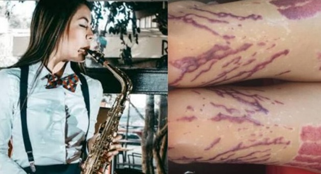 Imagen Detienen a segundo implicado en ataque con ácido a saxofonista oaxaqueña