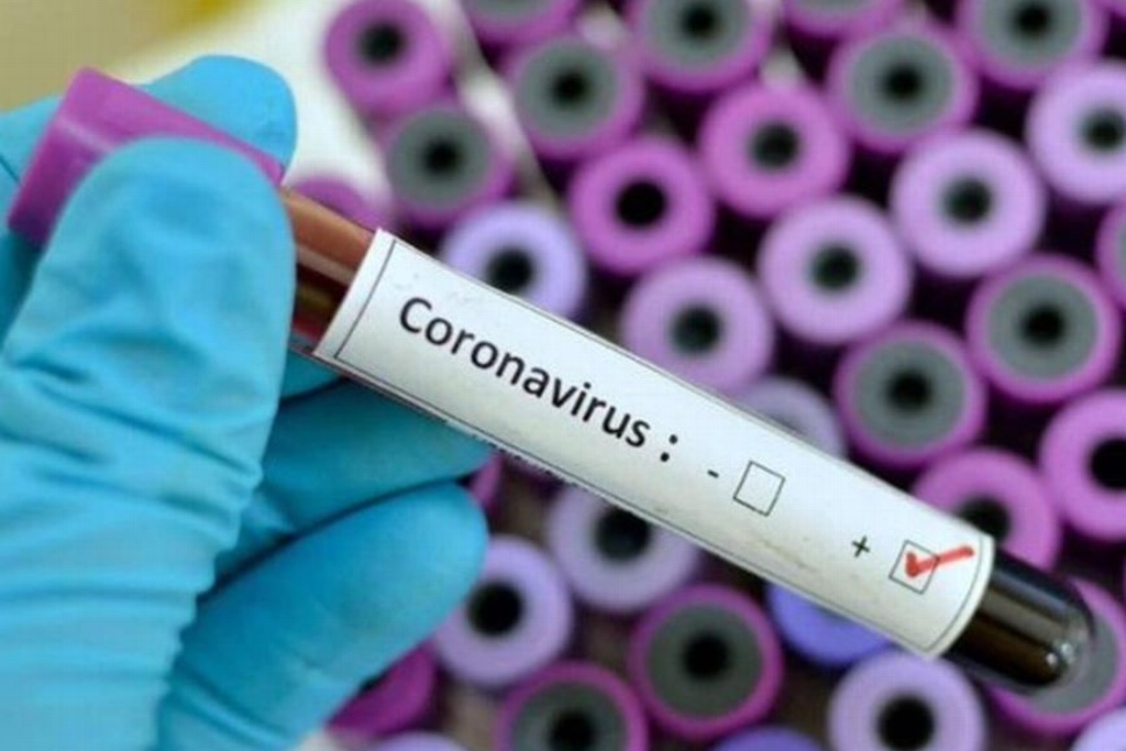 Imagen Coronavirus, una infección respiratoria que puede desencadenar neumonía: Médicos