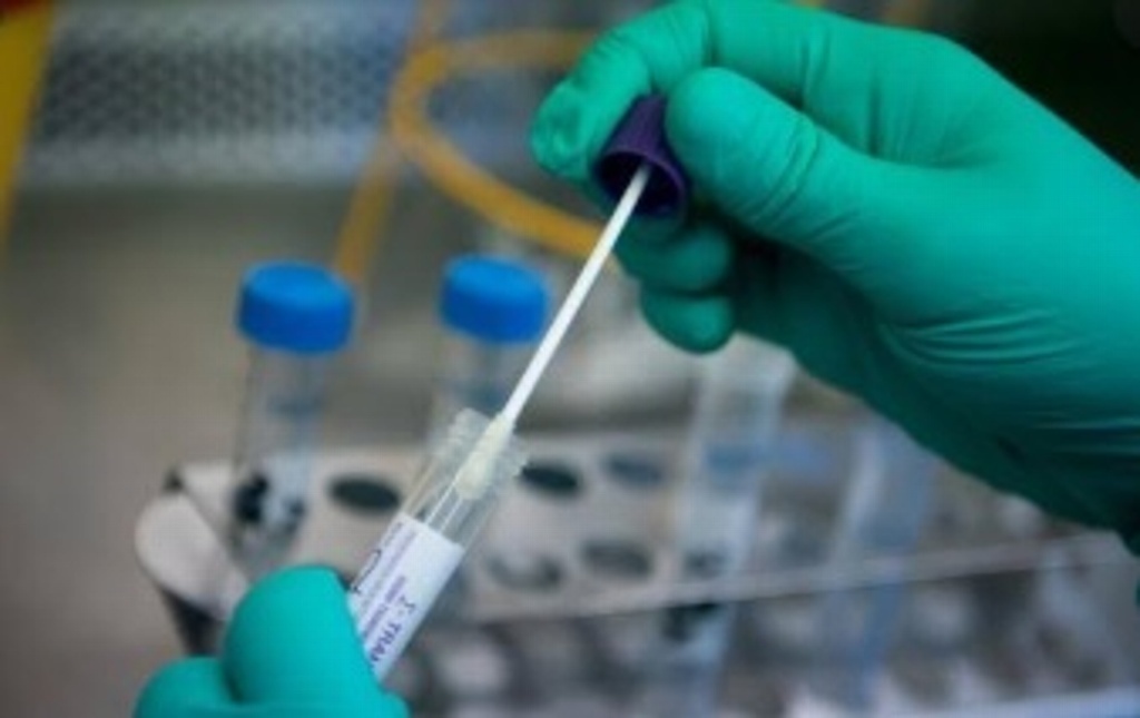 Imagen Estos son los laboratorios autorizados para hacer prueba de coronavirus