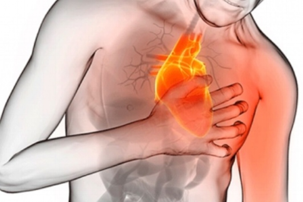 Imagen ¿Qué causa la insuficiencia cardíaca?