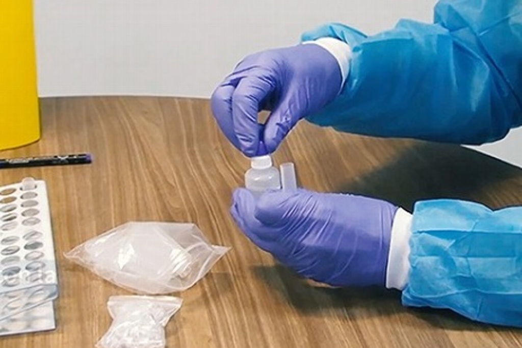 Imagen Gobierno de España compró miles de test para coronavirus con fallas