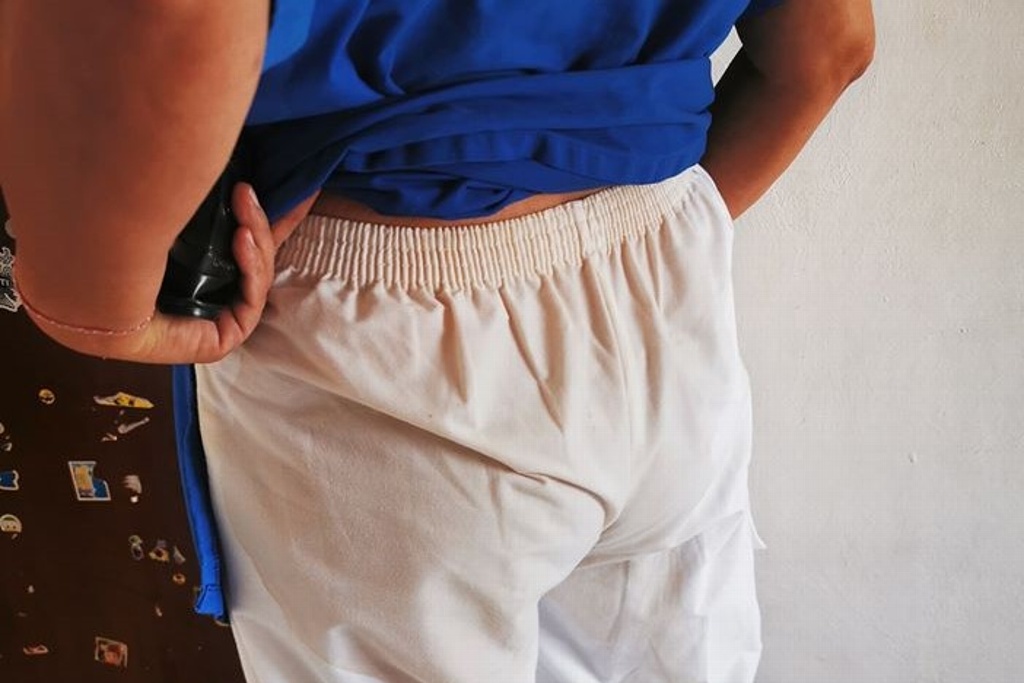Imagen Tiran café hirviendo a enfermera en Yucatán, le gritan: