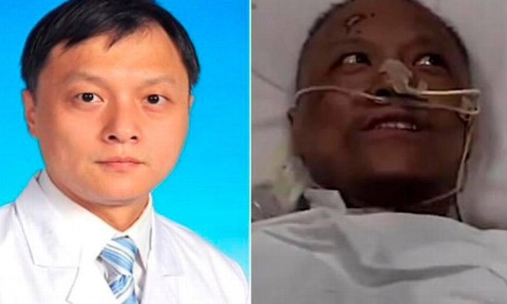 Imagen Muere uno de los médicos chinos que se volvió negro por un tratamiento contra COVID-19