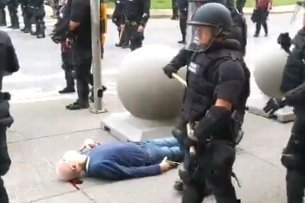 Imagen Policías empujan a abuelito y le provocan lesión grave en la cabeza (+video)