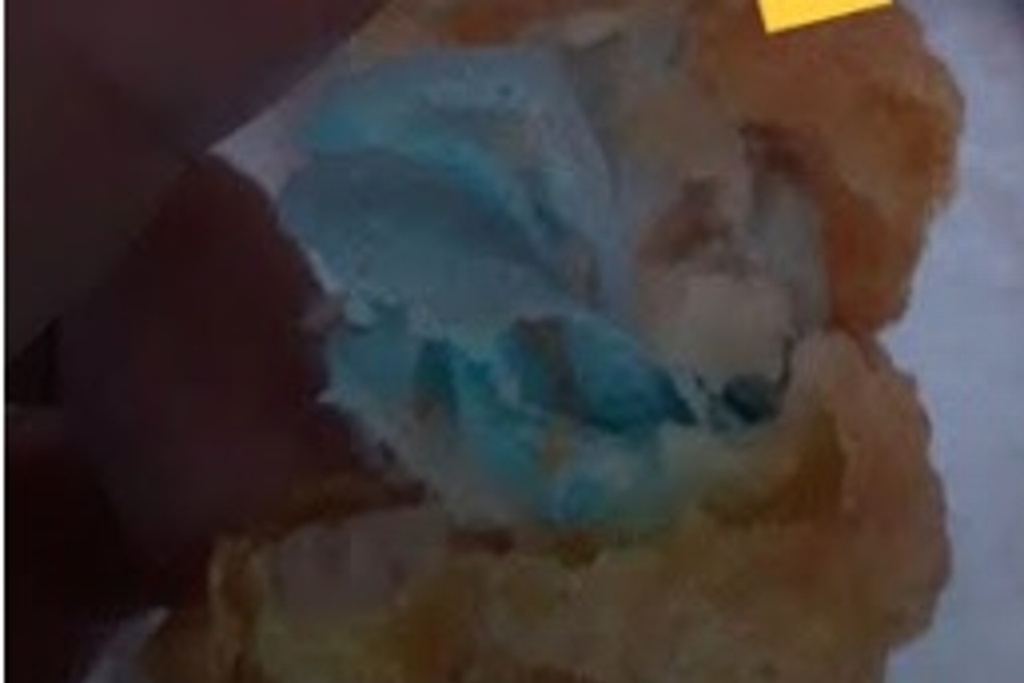 Imagen Niña de 6 años casi muere asfixiada; encuentran pedazos de cubrebocas en nuggets de pollo (+video)