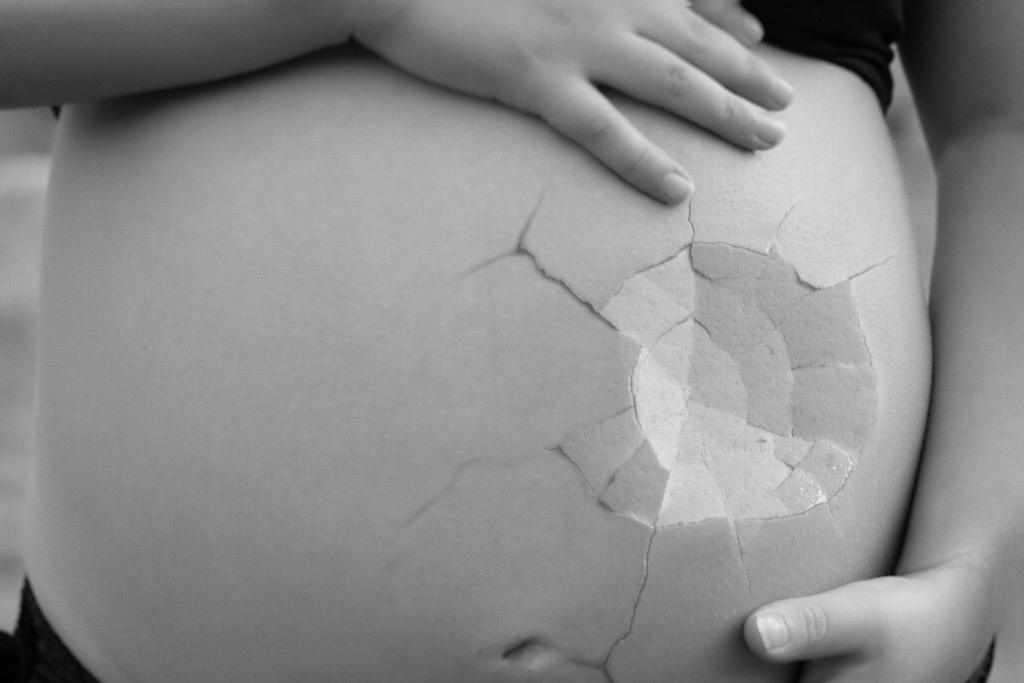 Imagen Advierten que medicamento usado para abortar puede causar la muerte