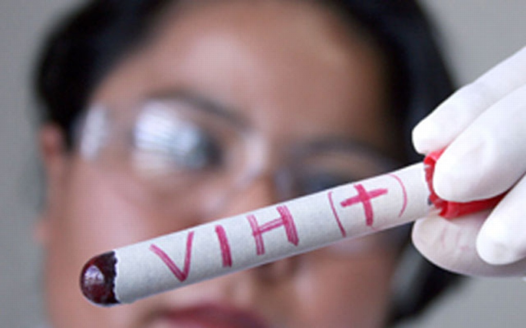 Imagen Una vacuna contra el VIH llega a última fase de ensayos por primera vez en 10 años 