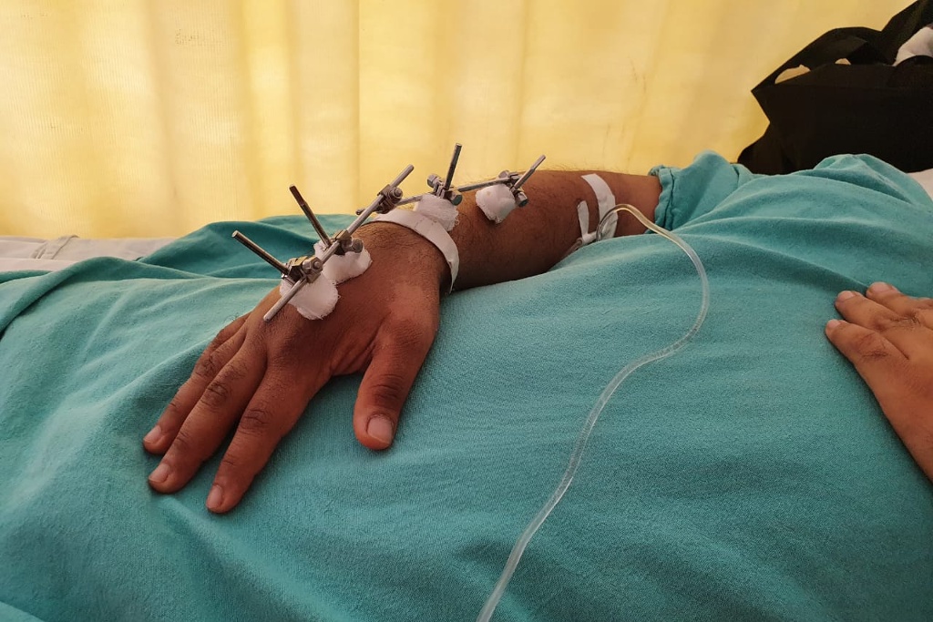 Imagen IMSS pone en marcha Centro de Atención en Traumatología en Córdoba, Veracruz
