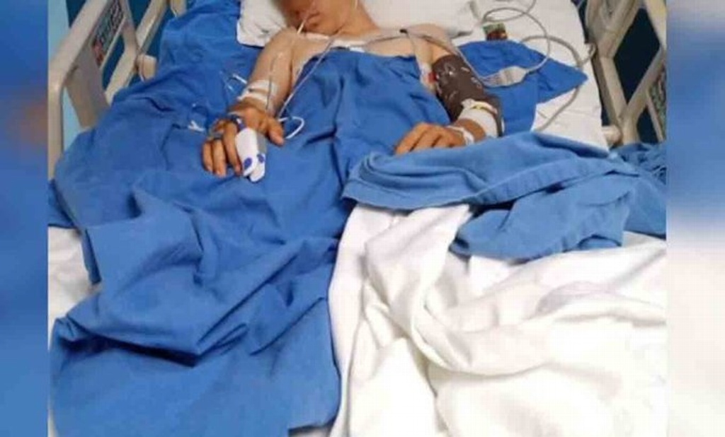 Imagen Amputan pierna a menor de 16 años tras presunto abuso policial