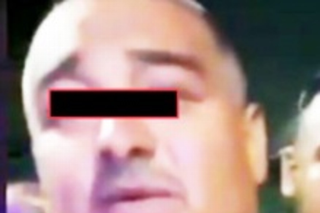 Imagen Bajó 40 kilos con manga gástrica y se operó la cara para no ser detenido
