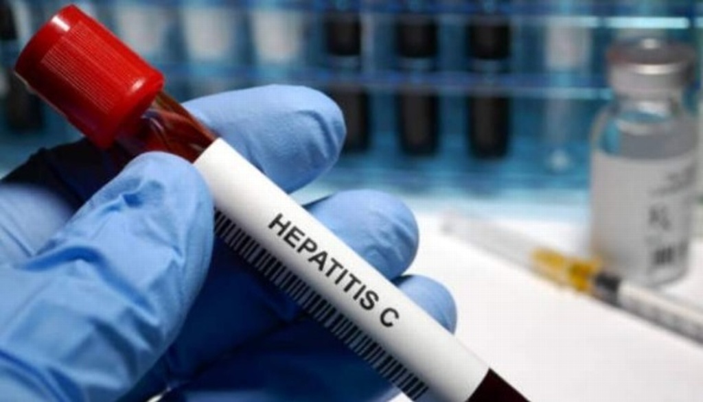 Imagen Tlacotalpan y Alvarado los municipios con más casos de Hepatitis C en el estado 