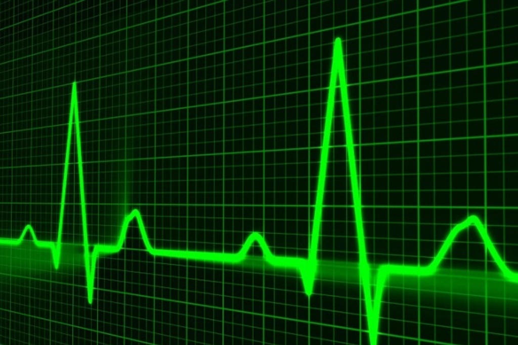 Imagen ¿Cómo saber si estoy propenso a un infarto fulminante? Esto señala cirujano