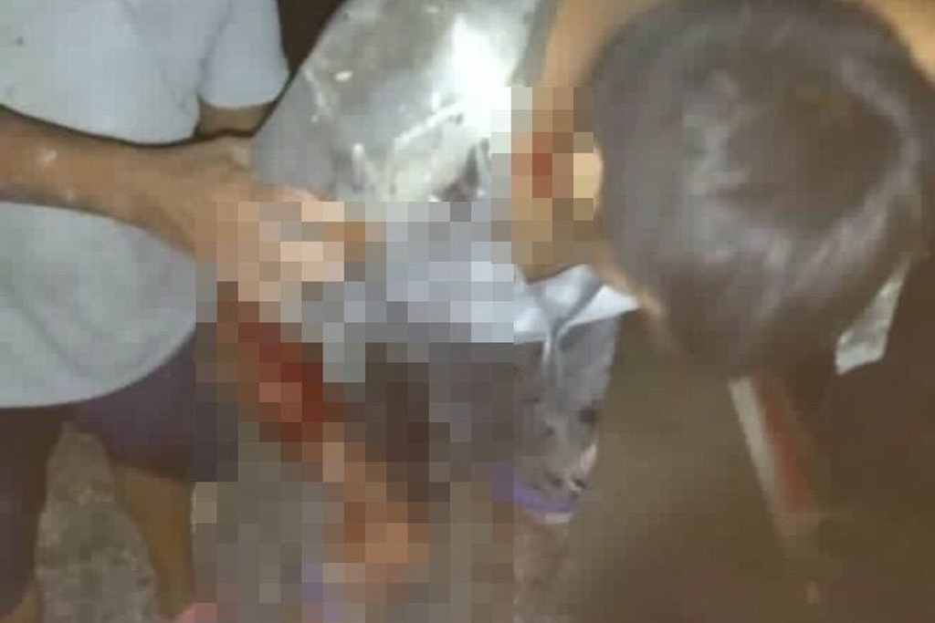 Imagen Perros pitbull atacan a joven en colonia de Veracruz, vecinos temen y piden ayuda (fotos)