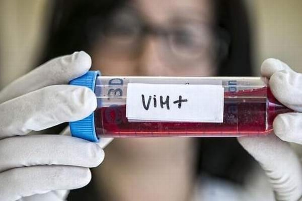 Imagen Estudio revela que tratamiento con proteínas sintéticas conduciría a la cura del VIH