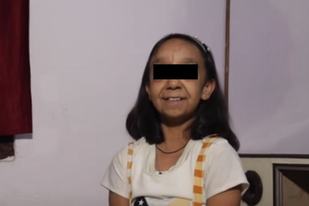 Imagen Extraña enfermedad en 2 niños los hace parecer de 80 años (+Video) 