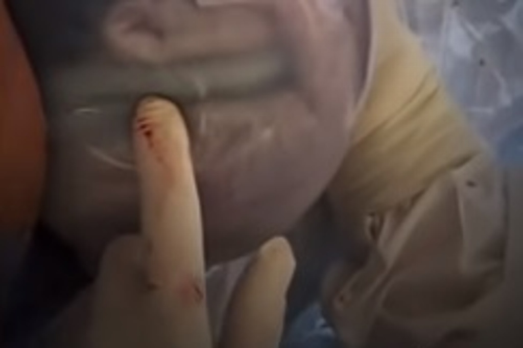 Imagen Viral, imágenes de bebé dentro de su bolsa amniótica (+Video)