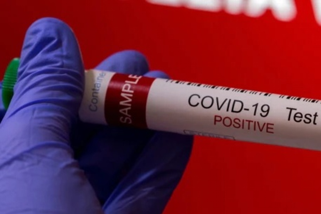 Imagen Confirman primer caso de la variante del COVID-19 ómicron en México