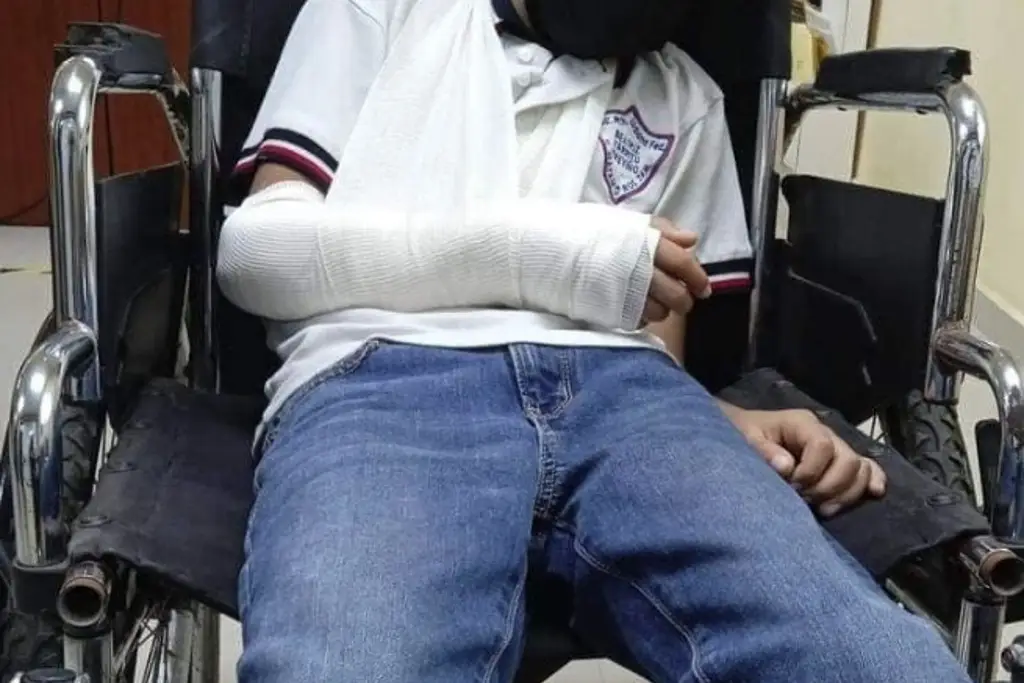 Imagen Le rompen el brazo a su hijo en la escuela y tiene que pagar 13 mil pesos