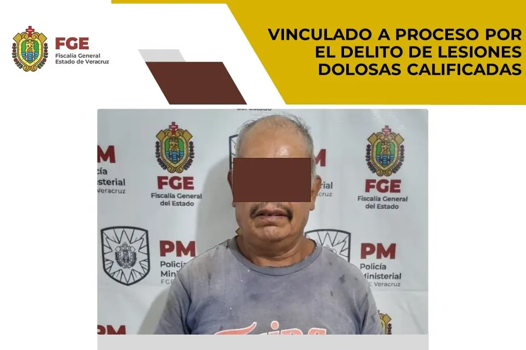 Imagen Lo vinculan a proceso por presunto delito de lesiones dolosas en Veracruz 