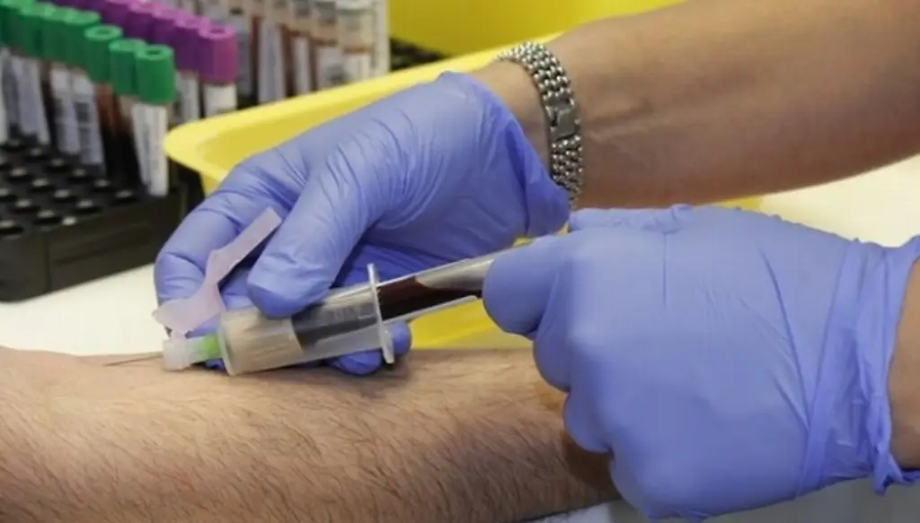 Imagen ¿Cuánto tiempo después de padecer COVID puede una persona donar sangre? 