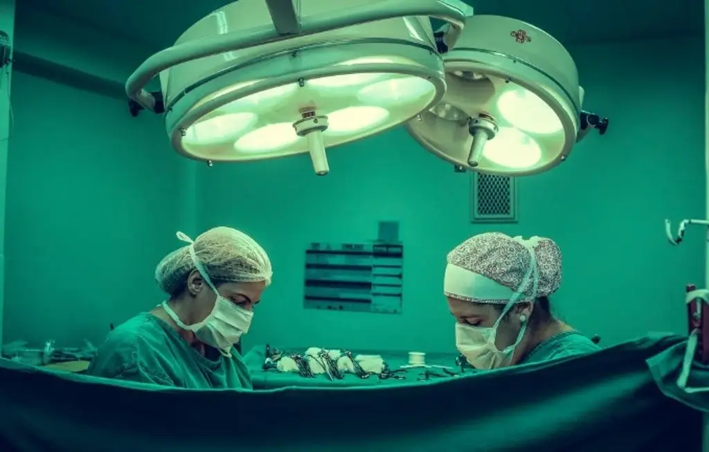 Imagen Logran separar a siameses unidos por la cabeza; duró casi un día la operación 