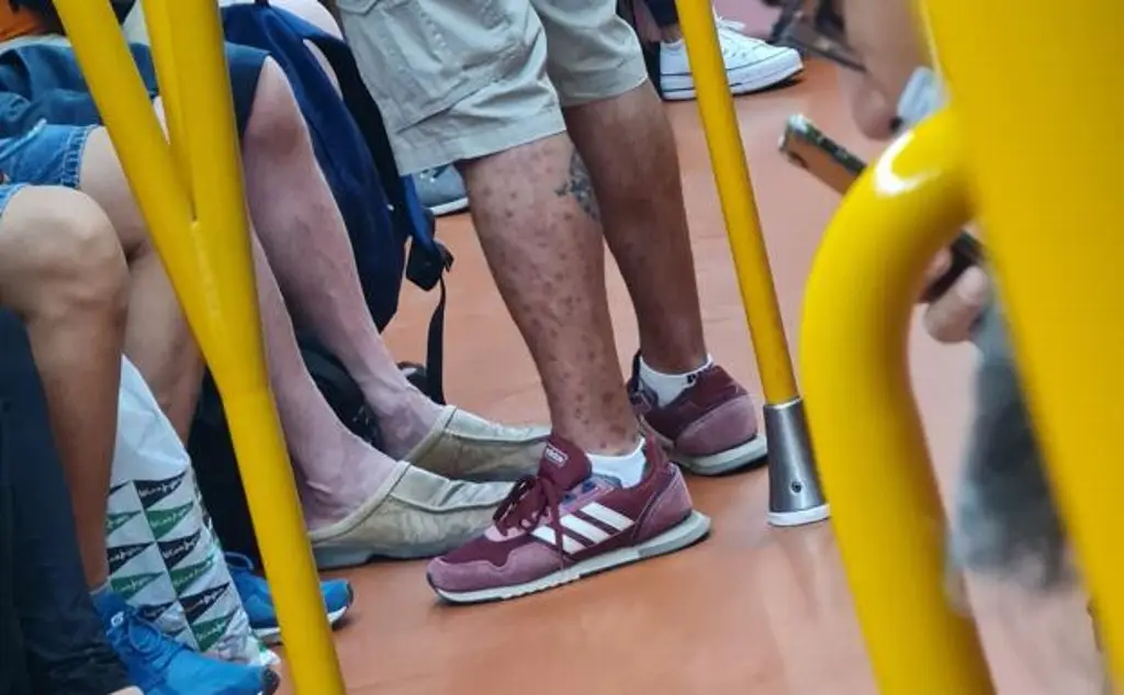 Imagen Captan a hombre contagiado de viruela del mono viajando en el metro