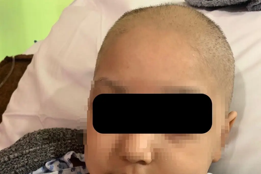 Imagen Acusan falta de atención a niña con cáncer en el cerebro, en el Hospital Infantil de Veracruz