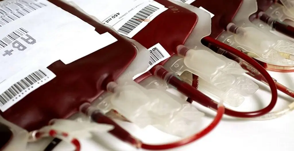 Imagen Piden donadores de sangre para menor que padece anemia aplásica grave