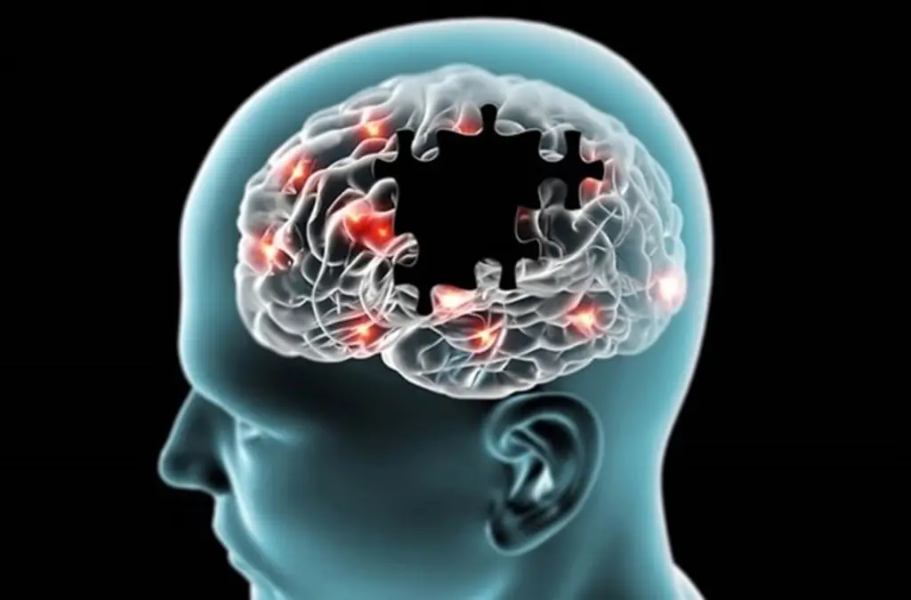 Imagen Desarrollan nuevas pruebas para determinar el riesgo de Alzheimer