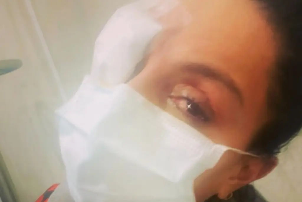 Imagen Ivonne Montero sufre trágico accidente en su ojo; 