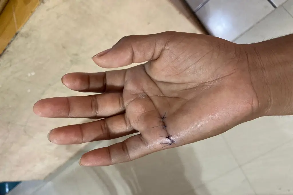 Imagen Por uso excesivo del celular operan a joven de Veracruz