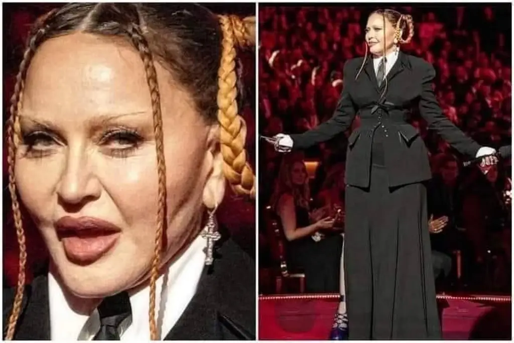 Imagen ¿Qué le pasó? Madonna luce irreconocible en los Grammy