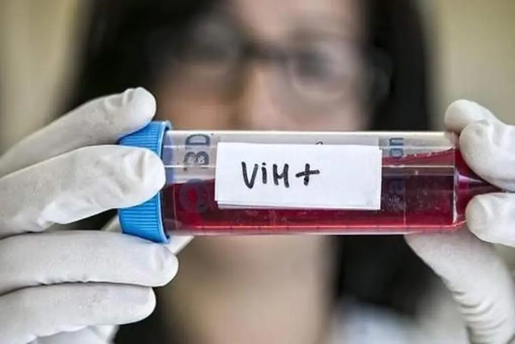 Imagen Tratamiento para cura de VIH no está al alcance de todos: Activista 