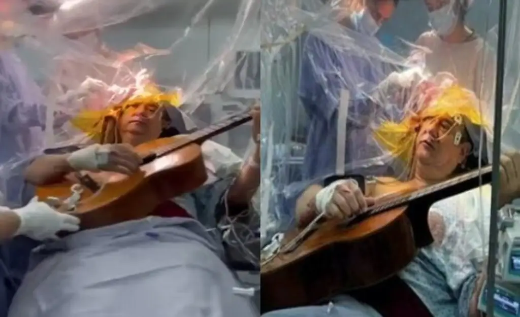 Imagen Le extirpan tumor con serenata en el quirófano (+Video)