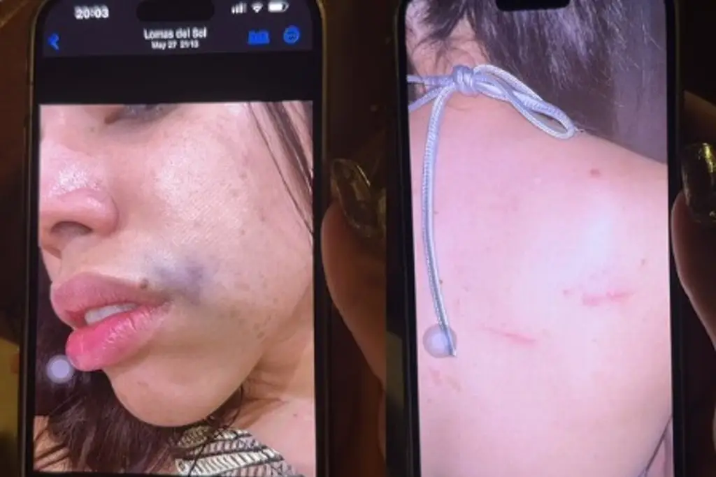 Imagen Yeri MUA se embaraza de Naim Darrechi; expone golpes 