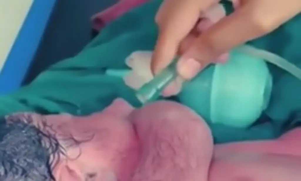 Imagen Viral, recién nacido que vuelve a la vida tras ser reanimado por médico (+Video) 