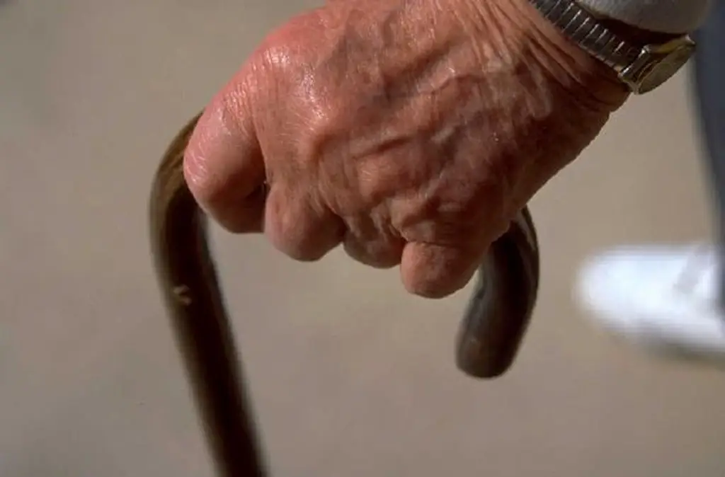 Imagen Alzheimer: ¿Qué es y cuáles son los signos de alarma?